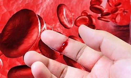 Pacientes hemofílicos