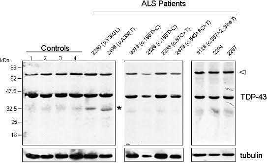 Western Blot