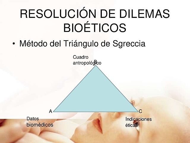 Método del Triángulo de Sgreccia