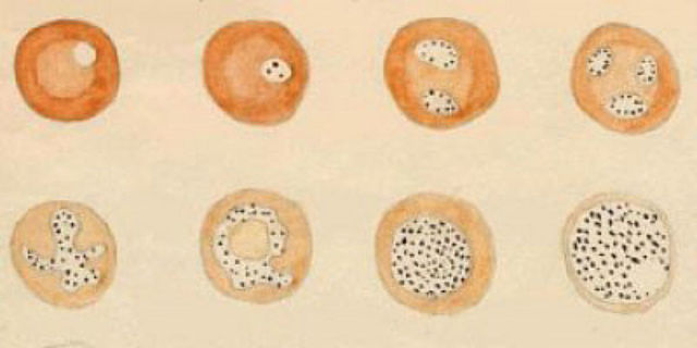 Charles Louis Alphonse Laveran