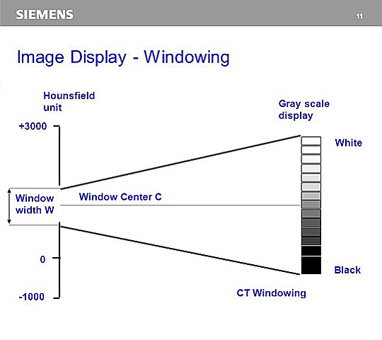 Técnica Windowing (usos de medios de contraste).