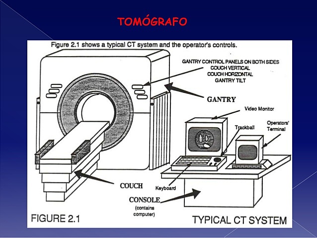 Se establecen componentes del TC.