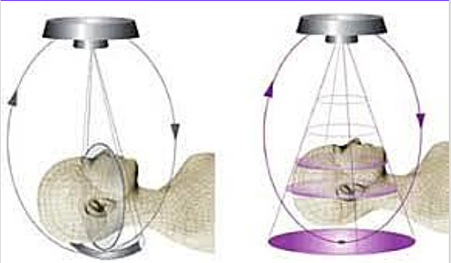 Primer escáner de haz de abanico.