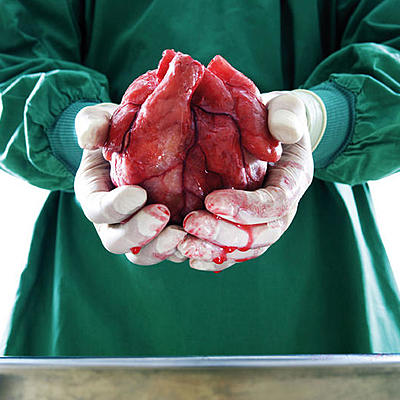 Timeline: Cuf (Transplantes y historia)