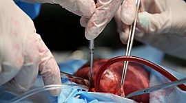 Timeline: LOS TRASPLANTES Y SU HISTORIA