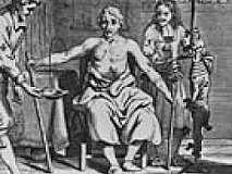 Primera transfusión de sangre.