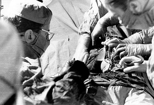 El primer trasplante renal con supervivencia a largo plazo.