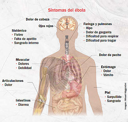 La epidemia de ébola de 2014