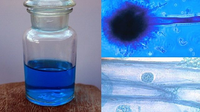 Primer uso del Azul de Metileno.