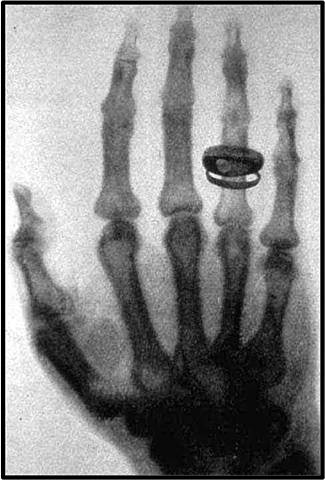 Descubrimiento de los rayos X