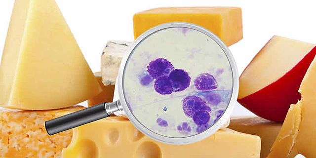 Crisis Hipertensivas