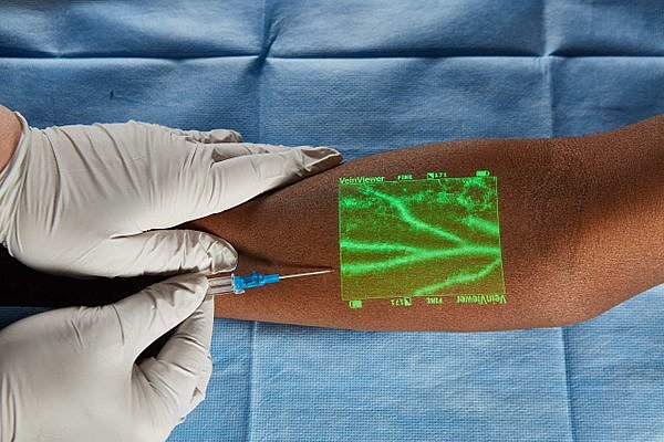 Εισαγωγή της βελόνης στη φλέβα και λήψη της απαιτούμενης ποσότητας αίματος.