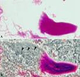 Feulgen y su tinción