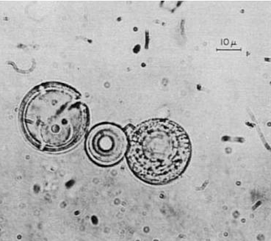 Microesferas de proteinoides de Fox