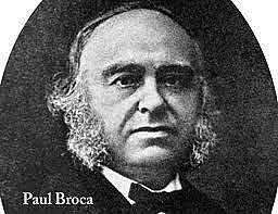 Paul Broca