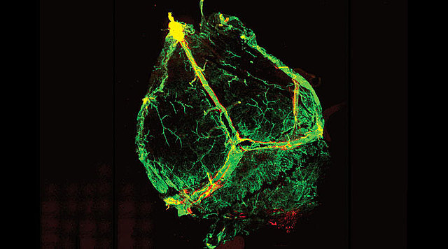 Sistema linfatico actua como el cerebro.