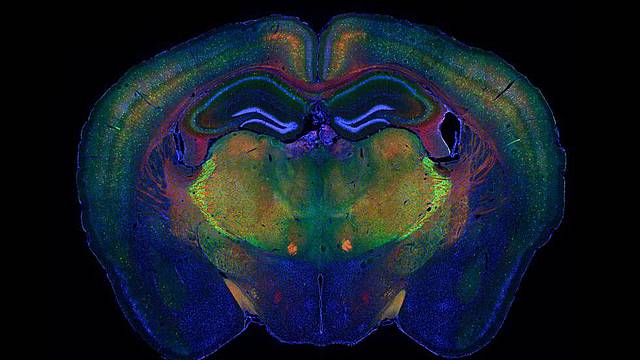 single cell RNA-seq.