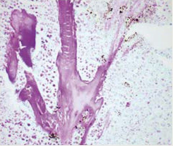 Feulgen y la tinción