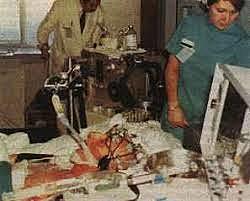 Enfermedad de Franco