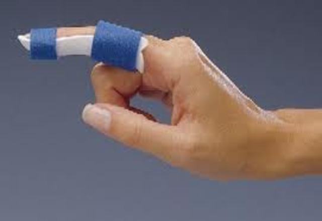 Got Hurt Bending my Finger