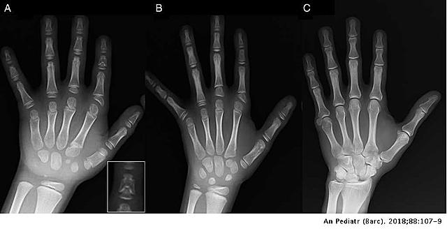 Hermann Muller y Lewis Stadler