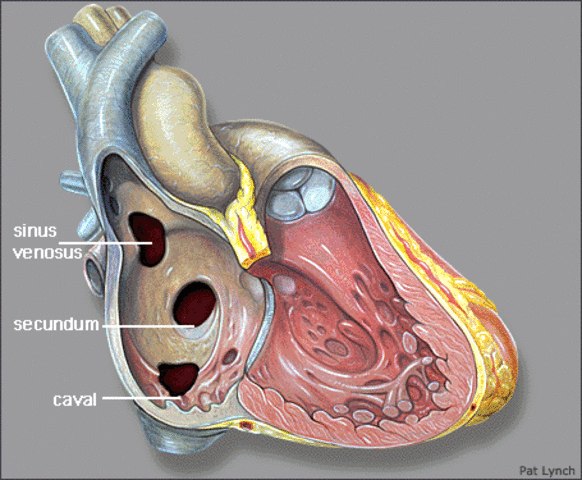 Exposition 1:Charactor