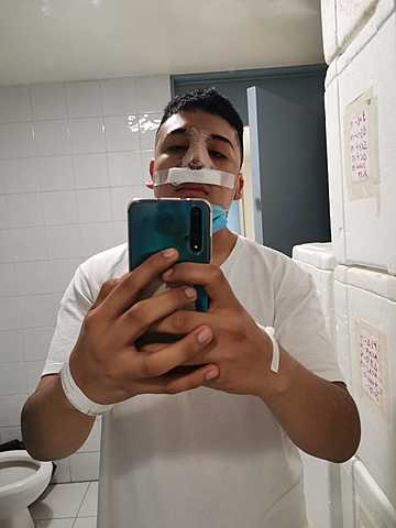 Momentos difíciles  -Alberto