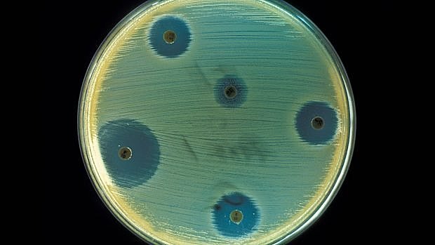 Descubrimiento de la penicilina.