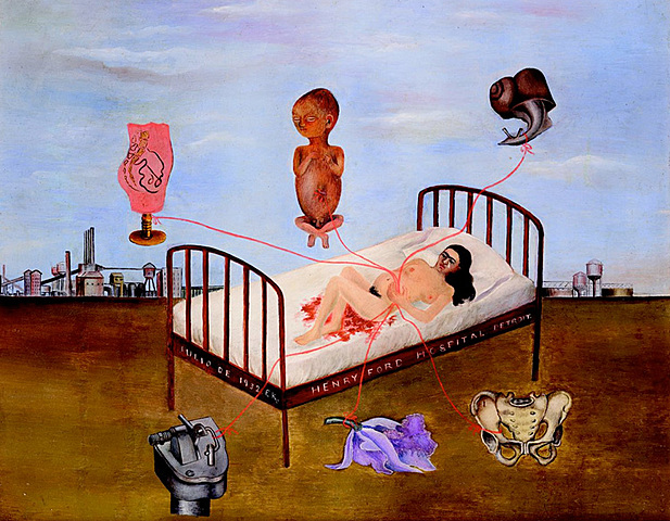 Hospital Henry Ford - Frida Kahlo