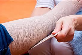 Me esguinzo la pierna