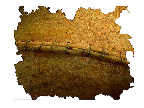 India. Procedimientos médicos