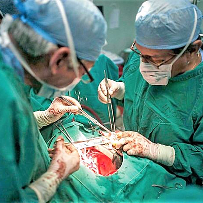 Timeline: Historia de los trasplantes