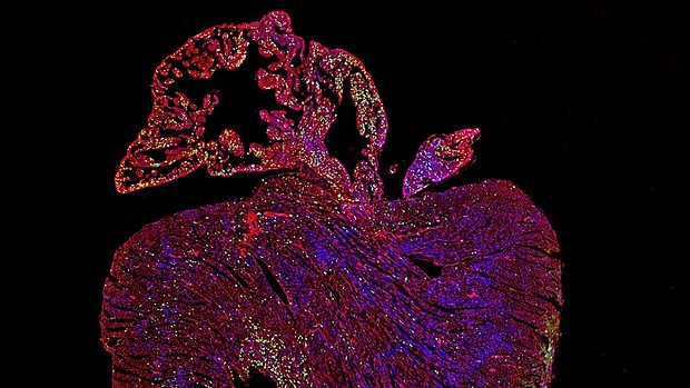 Vers le premier traitement curatif des maladies cardiaques