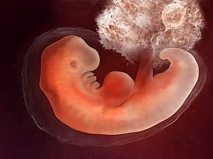 Fetal Development At 1 Month