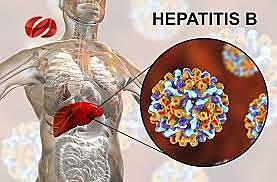 Lissence for the first hepatitis B vaccine