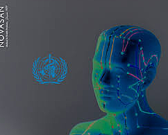 Medicina Tradicional China   Acupuntura