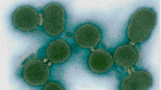 Craig Venter Institute