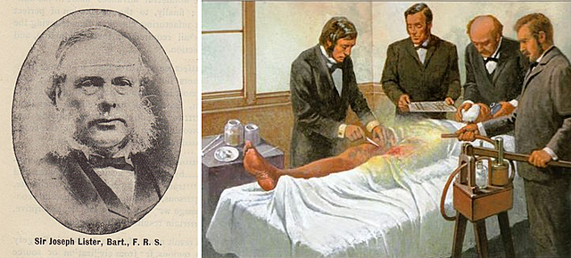 Joseph Lister: "Teoria Germinal"