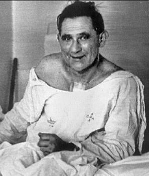 Primer trasplante de corazón en Sudáfrica