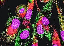 TERAPIAS CON CÉLULAS CAR-T