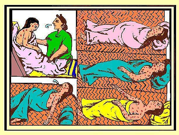 La epidemia que acabo con los indígenas