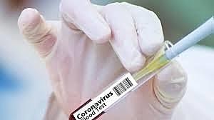 Los test de Sanidad no funcionan y China avisa que se compraron a una empresa sin licencia