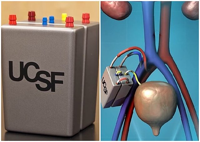 Países bajos, primer riñón artificial