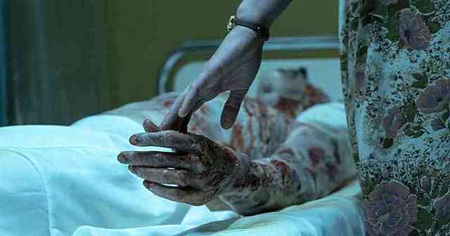 CHERNOBYL CONSEQUENCES