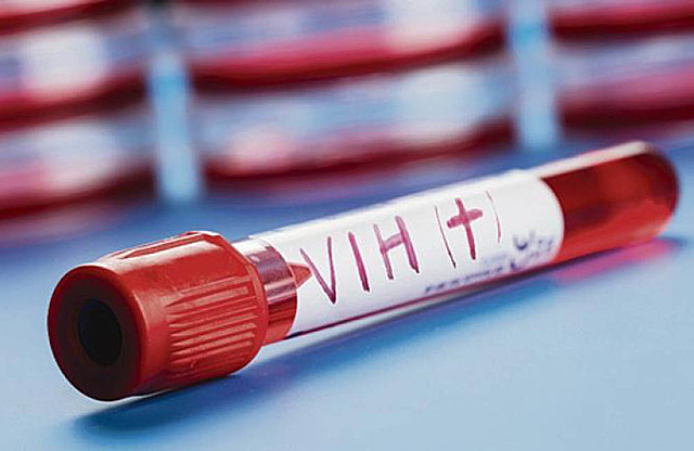 Se descubrió el SIDA