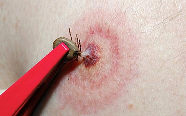 HOWARD TAYLOR RICKETTSDemuestra que la fiebre de las montañas rocosas es trasmitida por garrapatas