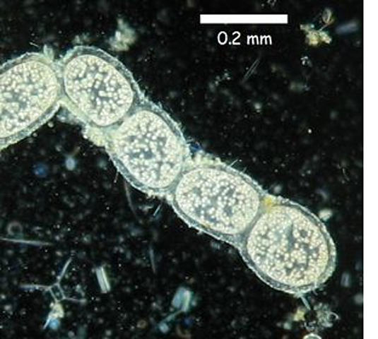 Se descubre la bacteria gigante thiomargarita mamibiensis