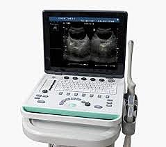 Ultrasound scanner