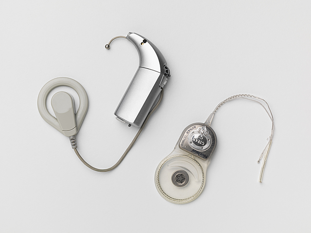 Cochlear implant (bionic ear)