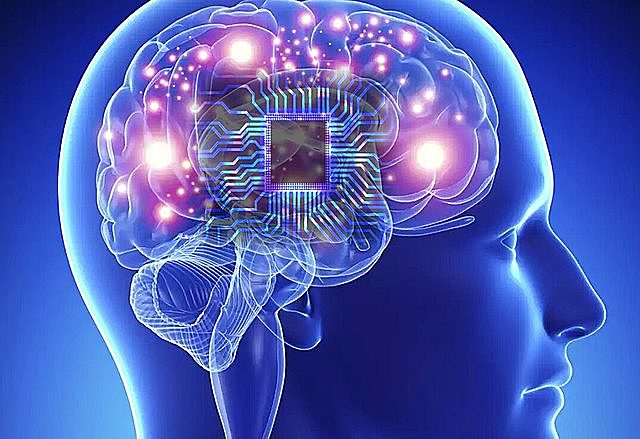 Implantes de memoria